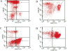 T-Cell Prolymphocytic Leukemia_Flow Cytometry