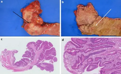 NUTRITIONAL DISEASE