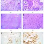 Adrenogenital Syndromes