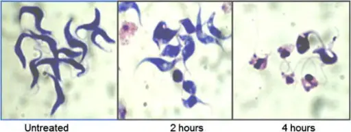 African Trypanosomiasis Infection