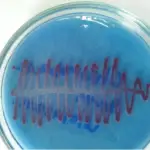 Anaerobes Causing Abscesses