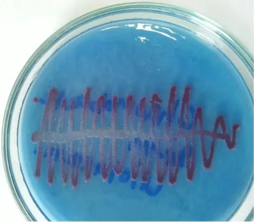 Anaerobes Causing Abscesses