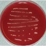 Anaerobic Bacterial Infections