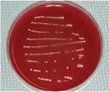 Anaerobic Bacterial Infections