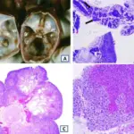 Anomalies of the Kidney