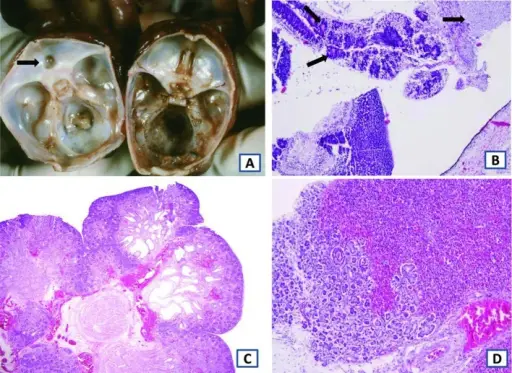 Anomalies of the Kidney