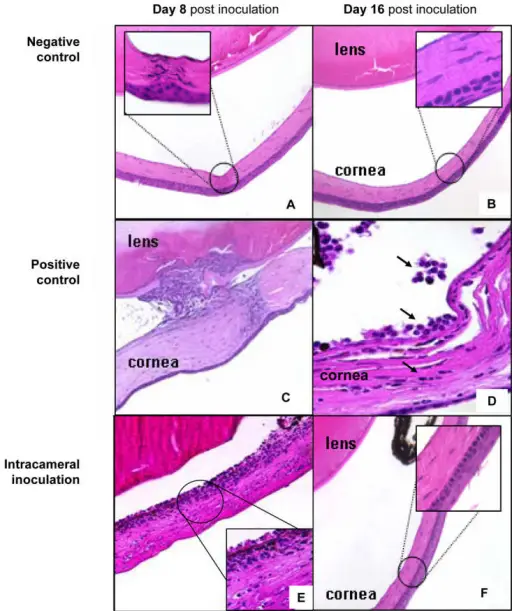 Anterior Segment Pathology