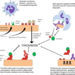 Anti Endothelial Cell Antibodies Vasculitis Replace