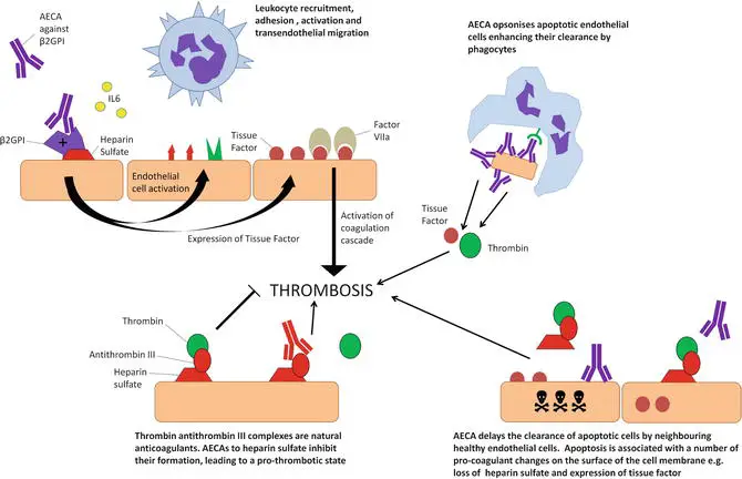 Anti Endothelial Cell Antibodies Vasculitis Replace