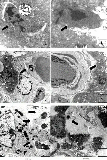 Apoptosis