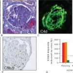 Atherosclerotic Ischemic Renal Disease