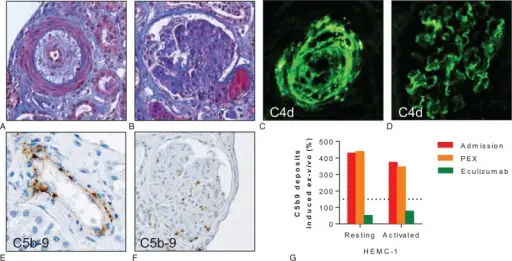 Atherosclerotic Ischemic Renal Disease