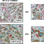 CELLULAR METABOLISM