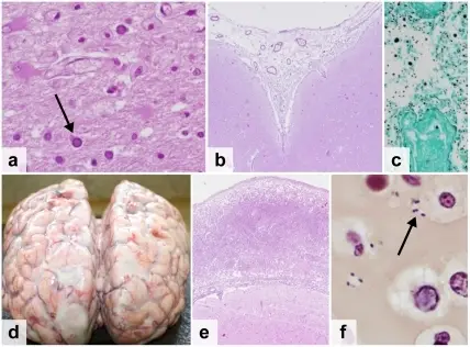 CENTRAL NERVOUS SYSTEM PATHOLOGY