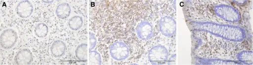 Campylobacter Enterocolitis