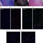 Cardiovascular Pathology