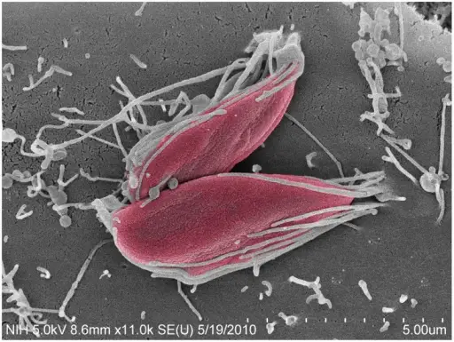 Chagas Disease Infection