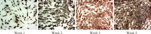 Chronic Ischemic Heart Disease