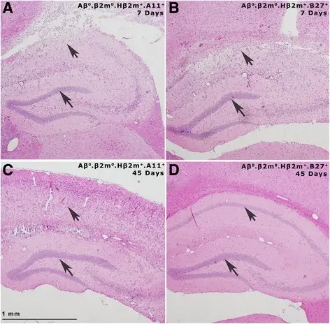 Chronic Neuronal Injury