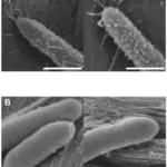 Clostridial Infections