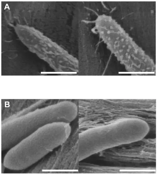 Clostridial Infections