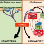 Coagulation Factor Defects