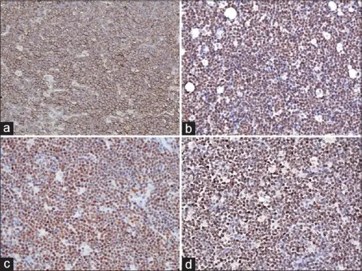 Common Malignant Tumors of the Young