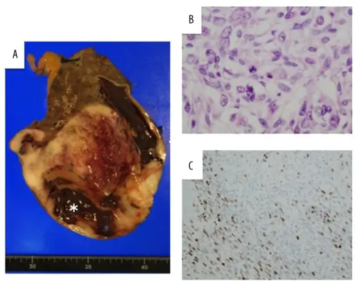 Conditions that Should be Assessed at an Autopsy