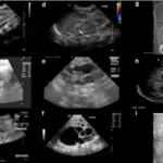 Congenital Anomalies