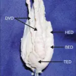 Congenital Anomalies of the Testis or Epididymi