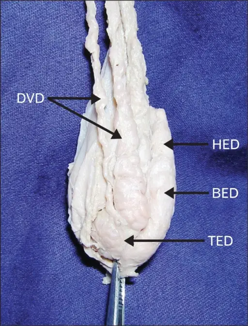 Congenital Anomalies of the Testis or Epididymi