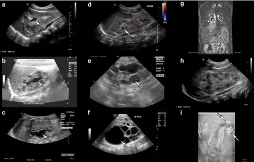 Congenital Anomalies