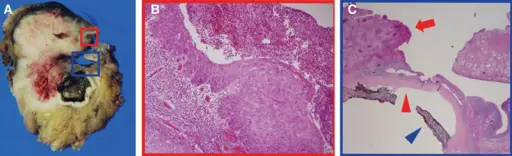 Conjunctiva Pathology