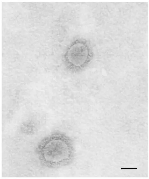 Coronavirus