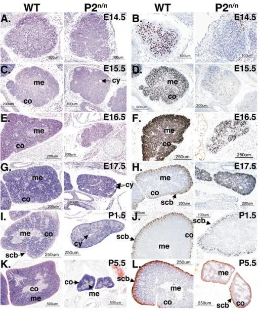 Developmental Disorders of the Thymus