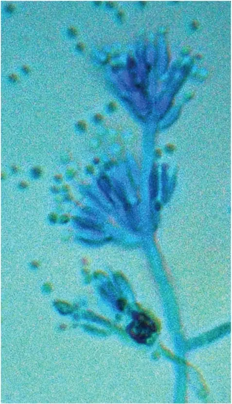 Dimorphic Fungal Infections