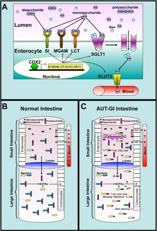 Disaccharidase Deficiency