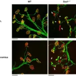 Diseases of the Neuromuscular Junction