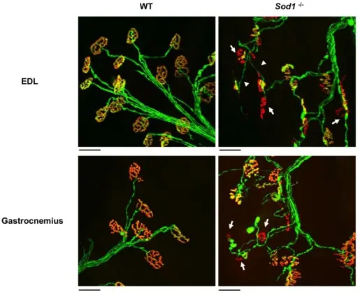 Diseases of the Neuromuscular Junction