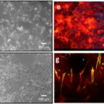 Diseases of the Skeletal Muscle System