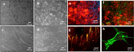 Diseases of the Skeletal Muscle System