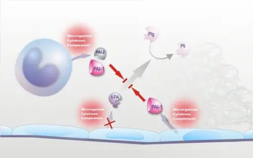 Disorders of Fibrinolysis