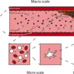 Disorders of Primary Hemostasis