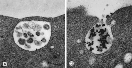 Exocytosis