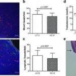 FAMILIAL HYPERCHOLESTEROLEMIA