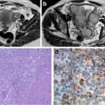 FEMALE GENITAL SYSTEM PATHOLOGY