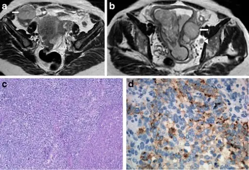 FEMALE GENITAL SYSTEM PATHOLOGY