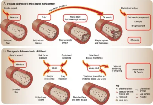 Familial Hypercholesterolemia