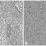 Familial Tumor Syndromes