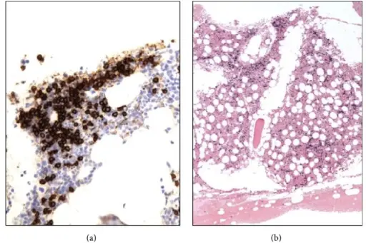 Features of Autoimmune Diseases